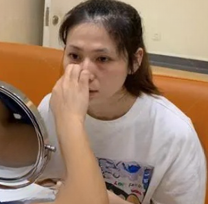 眼袋