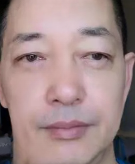 眼袋