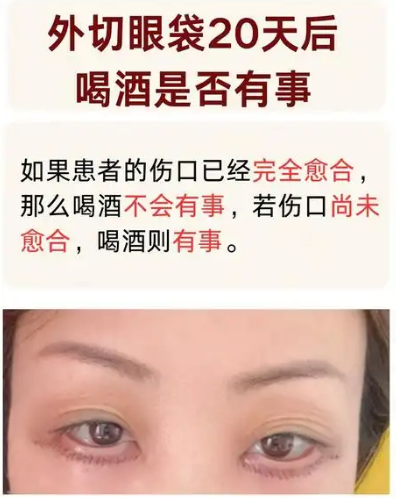 眼袋