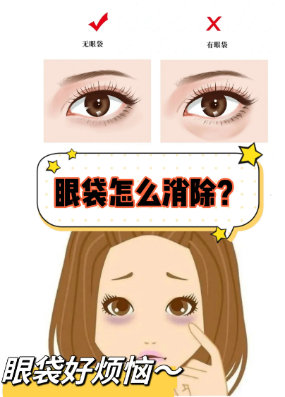 眼袋