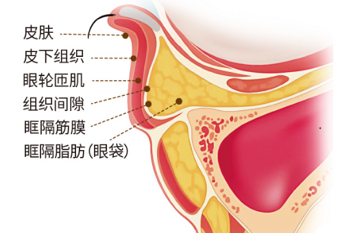 去眼袋手术
