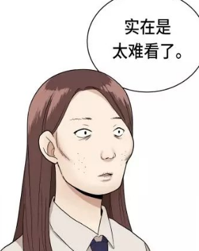 去眼袋手术