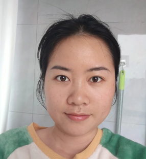 去眼袋手术