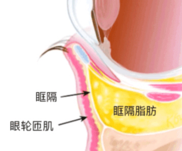 去眼袋手术