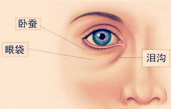 去眼袋手术