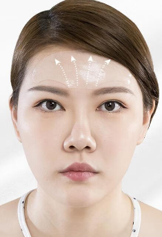 去眼袋手术