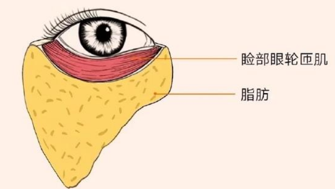 去眼袋手术