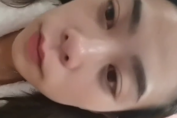 去眼袋手术