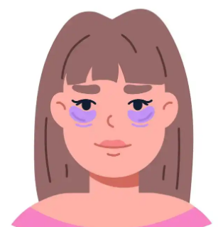眼袋