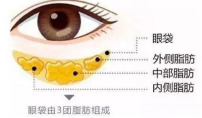眼袋