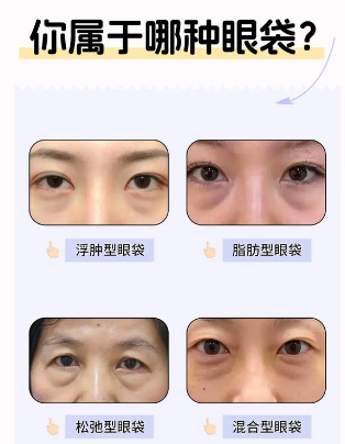 眼袋