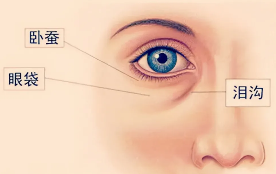 眼袋
