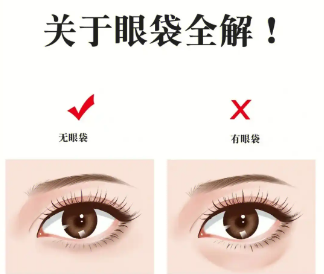 眼袋