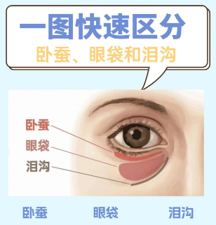 去眼袋手术