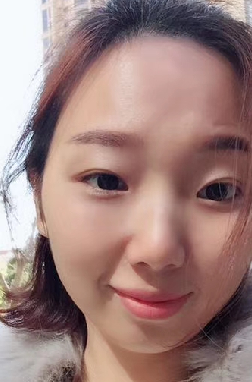 去眼袋手术