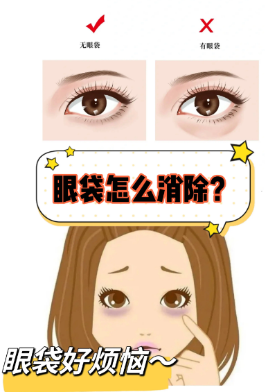 去眼袋手术