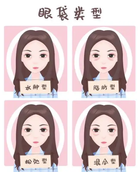 去眼袋手术