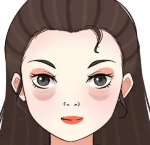 去眼袋手术