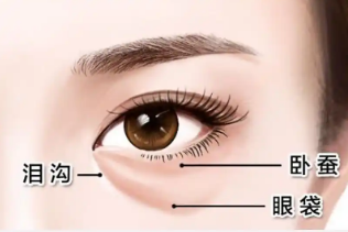 眼袋