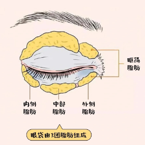 眼袋