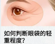 眼袋