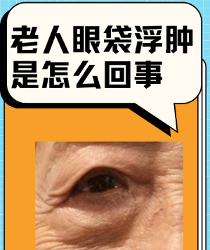 眼袋