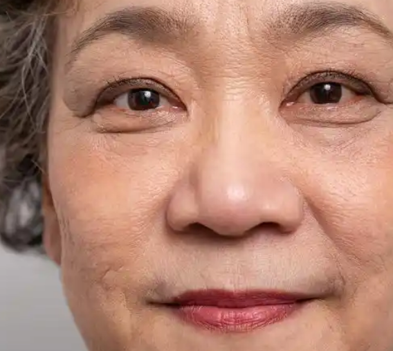 眼袋