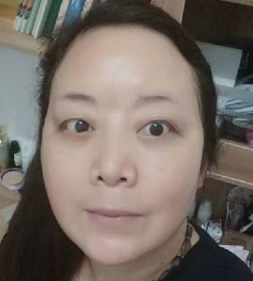 去眼袋手术