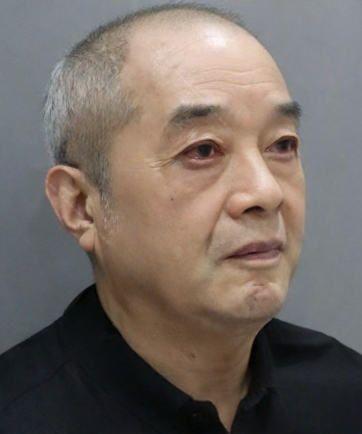 去眼袋手术