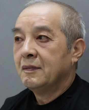 去眼袋手术