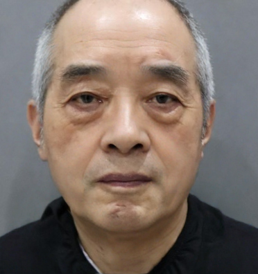 去眼袋手术
