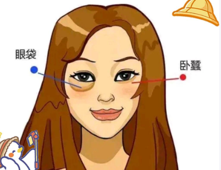 去眼袋手术