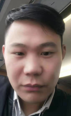去眼袋手术