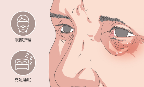 去眼袋手术