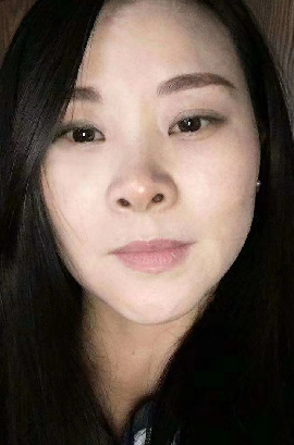 去眼袋手术