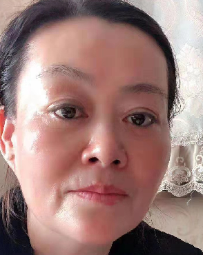 去眼袋手术