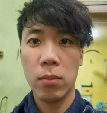 去眼袋手术