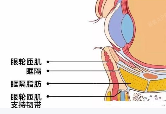 去眼袋手术