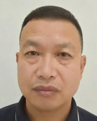 去眼袋手术