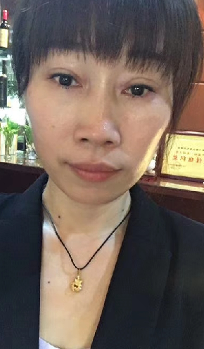 去眼袋手术