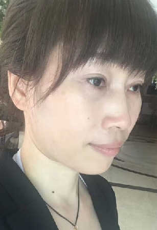 去眼袋手术