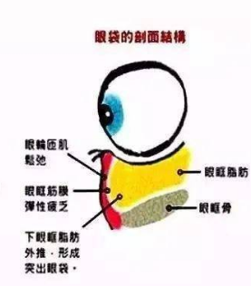 去眼袋手术