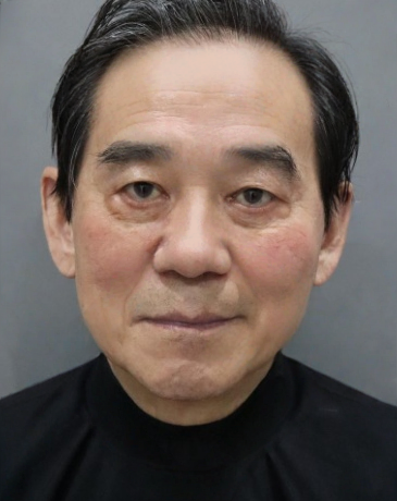 去眼袋手术