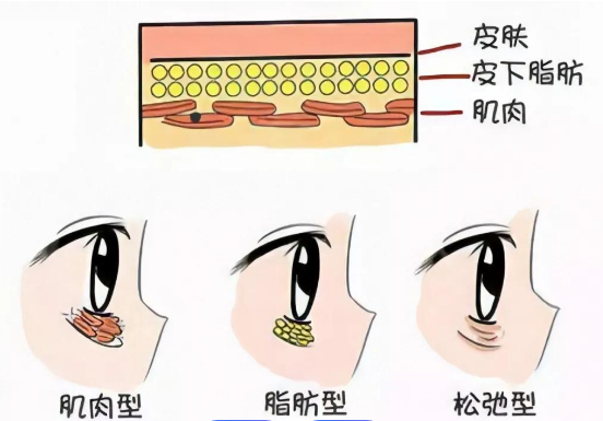 眼袋