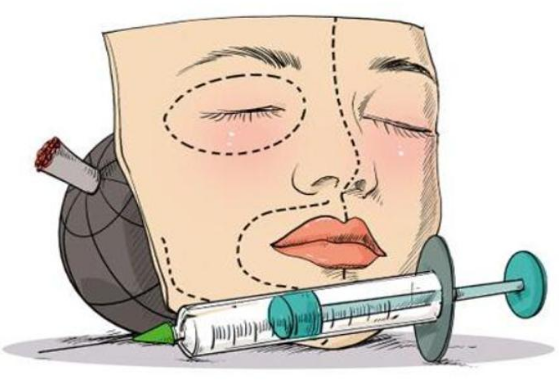 去眼袋手术