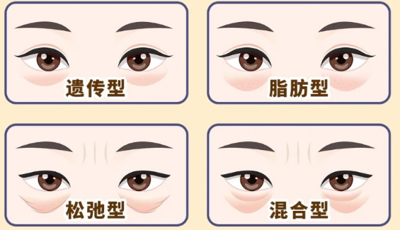 去眼袋手术