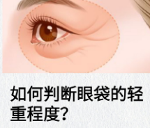 去眼袋手术