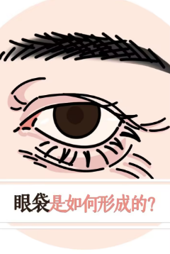 眼袋