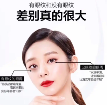 眼袋