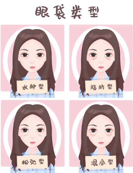 眼袋